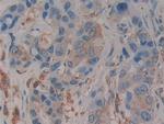 PSAP Antibody in Immunohistochemistry (Paraffin) (IHC (P))