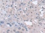 PSMA5 Antibody in Immunohistochemistry (Paraffin) (IHC (P))