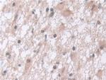 PSMA5 Antibody in Immunohistochemistry (Paraffin) (IHC (P))