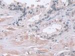 PSMA5 Antibody in Immunohistochemistry (Paraffin) (IHC (P))