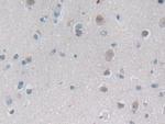 PSMB6 Antibody in Immunohistochemistry (Paraffin) (IHC (P))