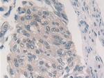 PSMB6 Antibody in Immunohistochemistry (Paraffin) (IHC (P))