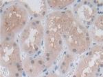 PSMB6 Antibody in Immunohistochemistry (Paraffin) (IHC (P))