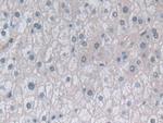 PSMB6 Antibody in Immunohistochemistry (Paraffin) (IHC (P))