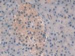 PSMB6 Antibody in Immunohistochemistry (Paraffin) (IHC (P))