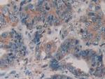 ERp72 Antibody in Immunohistochemistry (Paraffin) (IHC (P))