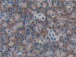 ERp72 Antibody in Immunohistochemistry (Paraffin) (IHC (P))