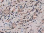 ERp72 Antibody in Immunohistochemistry (Paraffin) (IHC (P))