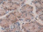 ERp72 Antibody in Immunohistochemistry (Paraffin) (IHC (P))