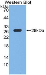 PTPRS Antibody in Western Blot (WB)