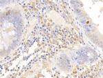 NPEPPS Antibody in Immunohistochemistry (Paraffin) (IHC (P))