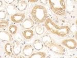 NPEPPS Antibody in Immunohistochemistry (Paraffin) (IHC (P))