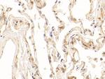 NPEPPS Antibody in Immunohistochemistry (Paraffin) (IHC (P))