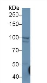 NPEPPS Antibody in Western Blot (WB)