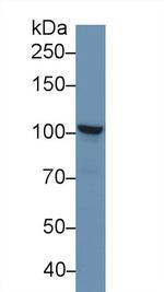 NPEPPS Antibody in Western Blot (WB)