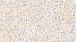 RANK (CD265) Antibody in Immunohistochemistry (Paraffin) (IHC (P))