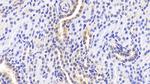 RANK (CD265) Antibody in Immunohistochemistry (Paraffin) (IHC (P))