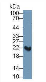 RBP4 Antibody in Western Blot (WB)