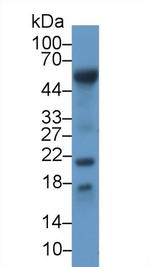 RBP7 Antibody in Western Blot (WB)