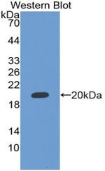 Rbm20 Antibody in Western Blot (WB)