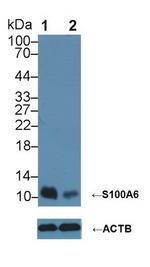 S100A6 Antibody in Western Blot (WB)