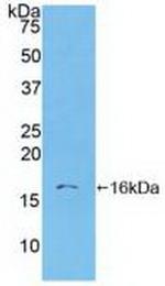 S100A6 Antibody in Western Blot (WB)