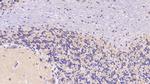 SEMA5B Antibody in Immunohistochemistry (Paraffin) (IHC (P))