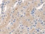 SPTLC1 Antibody in Immunohistochemistry (Paraffin) (IHC (P))