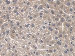 SPTLC1 Antibody in Immunohistochemistry (Paraffin) (IHC (P))