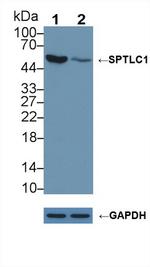 SPTLC1 Antibody in Western Blot (WB)