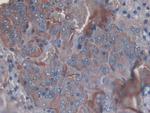 SLIT1 Antibody in Immunohistochemistry (Paraffin) (IHC (P))