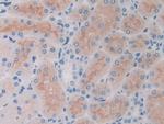 SLIT1 Antibody in Immunohistochemistry (Paraffin) (IHC (P))