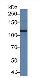 SLIT1 Antibody in Western Blot (WB)