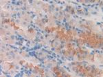 SLIT1 Antibody in Immunohistochemistry (Paraffin) (IHC (P))