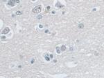 SNRPD1 Antibody in Immunohistochemistry (Paraffin) (IHC (P))