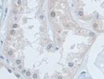 SNRPD1 Antibody in Immunohistochemistry (Paraffin) (IHC (P))