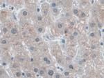 SNRPD1 Antibody in Immunohistochemistry (Paraffin) (IHC (P))