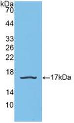 SNRPD1 Antibody in Western Blot (WB)