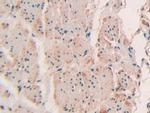 SP100 Antibody in Immunohistochemistry (Paraffin) (IHC (P))