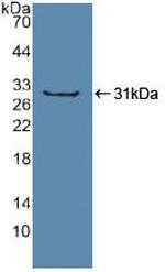 SP100 Antibody in Western Blot (WB)