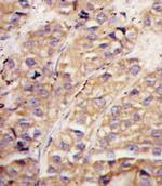 SMURF1 Antibody in Immunohistochemistry (Paraffin) (IHC (P))