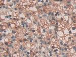 SPRY3 Antibody in Immunohistochemistry (Paraffin) (IHC (P))