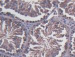 SDF2L1 Antibody in Immunohistochemistry (Paraffin) (IHC (P))