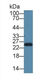 SDF2L1 Antibody in Western Blot (WB)