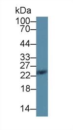 SDF2L1 Antibody in Western Blot (WB)