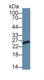 SDF2L1 Antibody in Western Blot (WB)