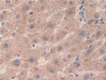 SMC3 Antibody in Immunohistochemistry (Paraffin) (IHC (P))