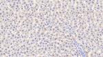 SOD2 Antibody in Immunohistochemistry (Paraffin) (IHC (P))