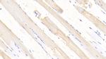 SOD2 Antibody in Immunohistochemistry (Paraffin) (IHC (P))