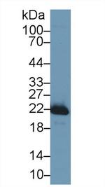 SOD2 Antibody in Western Blot (WB)